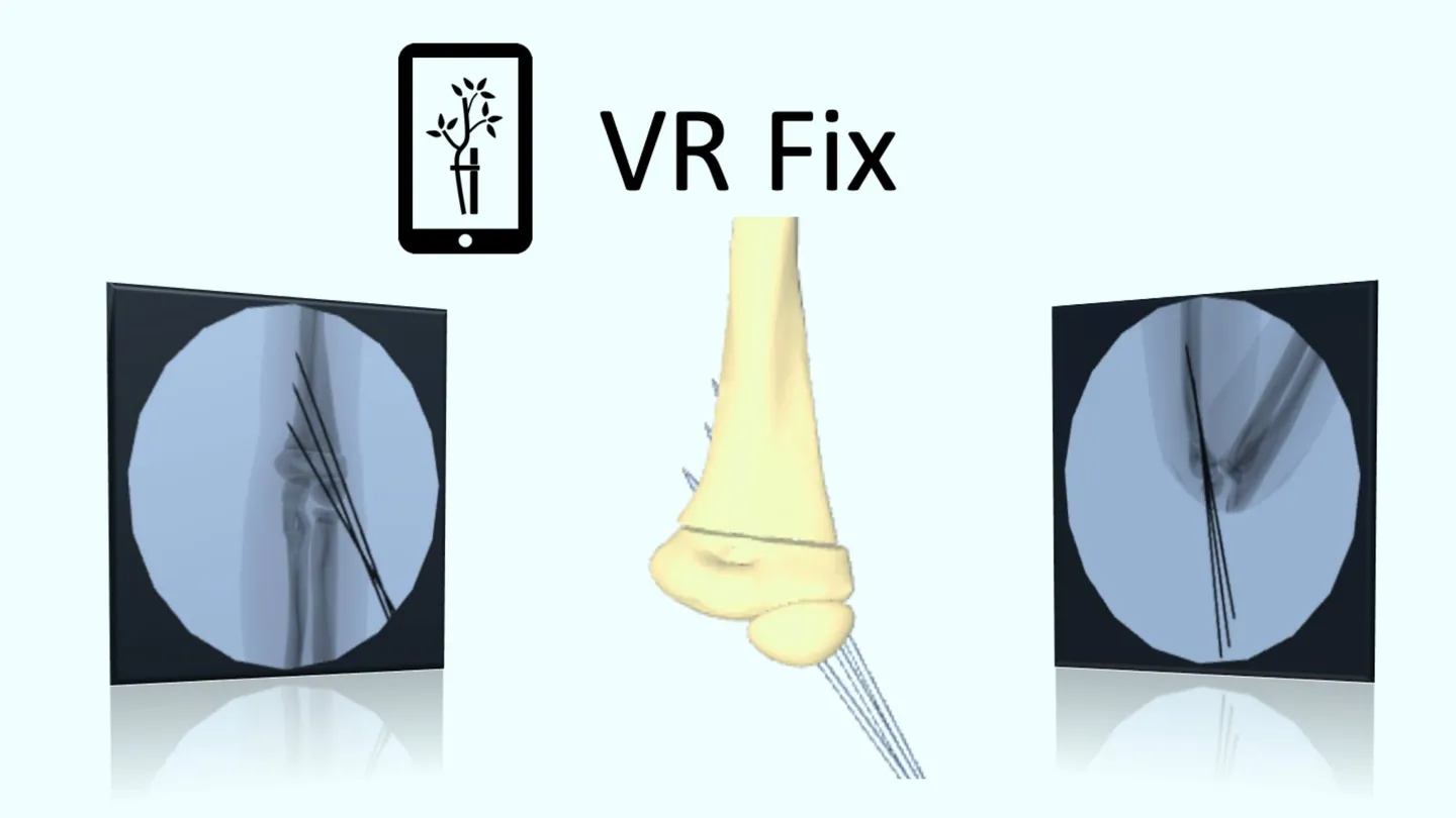Meta Quest 游戏《X射线模拟》VR Fix Supra